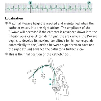 Localisation-Product Picture Enlargement CW