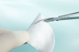 Lyoplant® Onlay-Substituto de duramater biológico dois em um: suturável ou não.